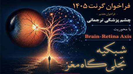  فراخوان هفتم گرنت چشم‌پزشکی ترجمانی با محوریت «محور مغز-شبکیه» منتشر شد
